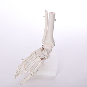 Bigfoot joint model