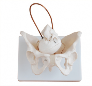 Contributing to safe delivery: The importance of the fetal head pelvis model