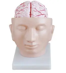 How does the cephalic artery model show the cerebral artery system?