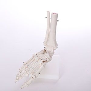 Can the Bigfoot joint model improve the accuracy and success rate of foot surgery?