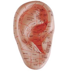 Ear acupuncture model: Can it improve the clinical efficacy of ear acupuncture? 