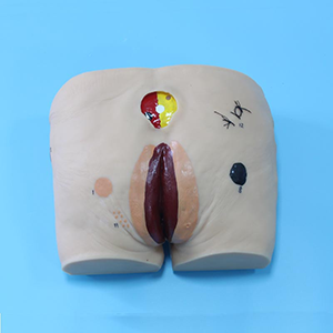 Advanced pressure ulcer care model