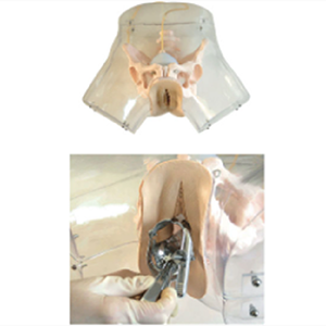 The function of the advanced transparent curettage model