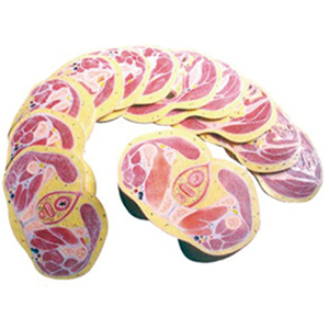 Anatomical model of transverse faults in the female pelvis